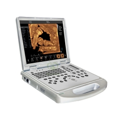 MY-A024B-N Portable Medical Digital Laptop Color Doppler Ultrasound Machine