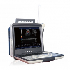 MY-A027C 15 inch LCD monitor portable ultrasound diagnostic system doppler ultrasound machine