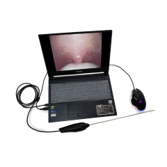MY-P008M médico profissional endoscópio eletrônico portátil otorrinolaringologista