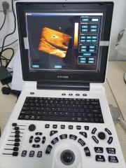 MY-A024N 12 polegadas laptop colorido doppler máquina de scanner de ultrassom