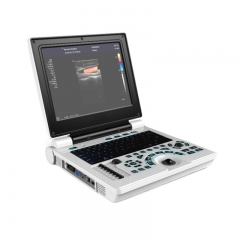 MY-A024N 12 polegadas laptop colorido doppler máquina de scanner de ultrassom