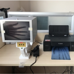 Máquina de raios-X de fluoroscopia MY-D001C