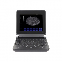 Profissional médico MY-A007C Laptop BW Scanner de ultrassom