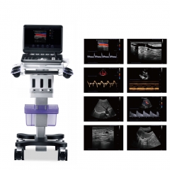 Sistema diagnóstico portátil do ultrassom do Doppler da cor MY-A032A-C